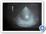 C Wurf erste Ultraschallbilder